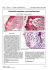 Eosinofilia sanguínea y sus implicaciones