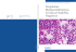 Neoplasias Mieloproliferativas