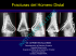 Fracturas del Húmero Distal