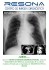 exploración radiologica del torax