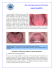 HOJA DE INFORMACIÓN PARA EL PACIENTE Lengua Geográfica